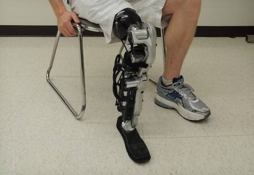 安裝假肢的過(guò)程步驟鄭州假肢廠家(圖1) 安裝假肢的過(guò)程步驟鄭州假肢廠家(圖1)