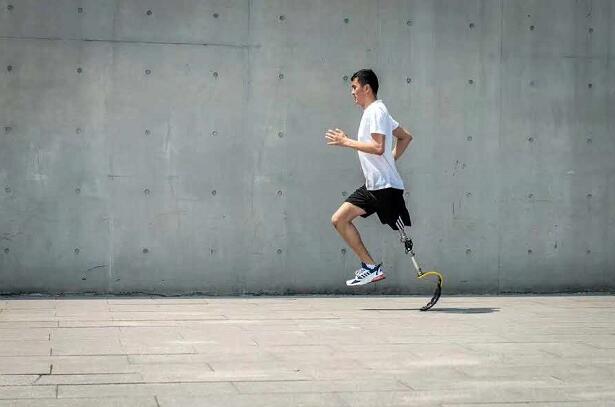 假肢如何與截肢患者的肢體完美融合?(圖1) 假肢