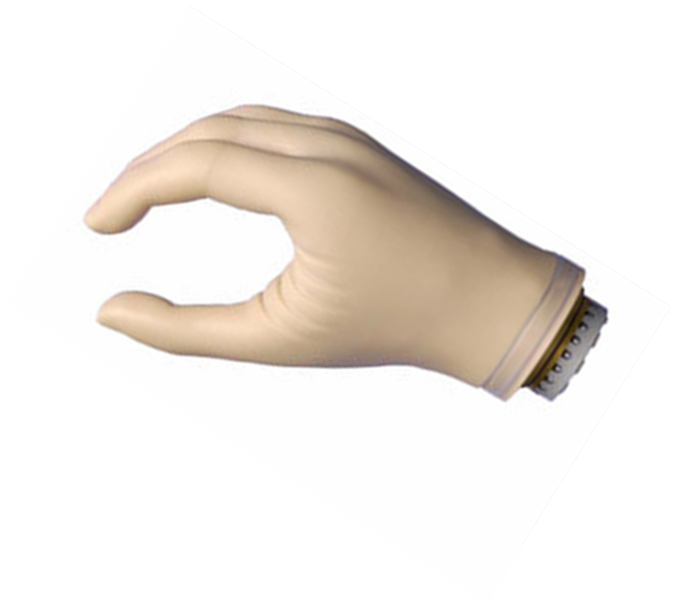 截肢者假肢可能出現(xiàn)的術后癥狀(圖1) 截肢者假肢可能出現(xiàn)的術后癥狀