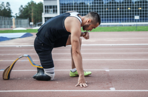 安裝假肢之后是否可以運(yùn)動(dòng)健身?(圖2) 假肢