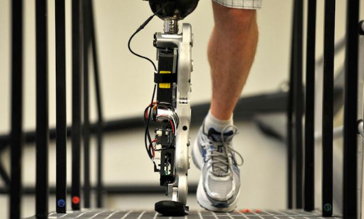 河南假肢淺談小腿假肢的功能及分類(lèi)(圖1) 假肢