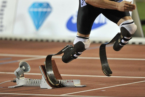 踝足支具對(duì)足下垂患者的作用(圖1) 假肢價(jià)格